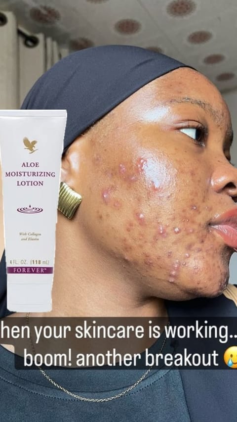 Aloe moisturizing lotion with collagen 